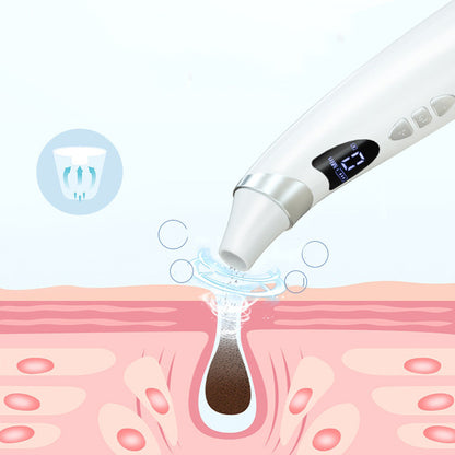 Electric Visual Blackhead Suction Instrumen